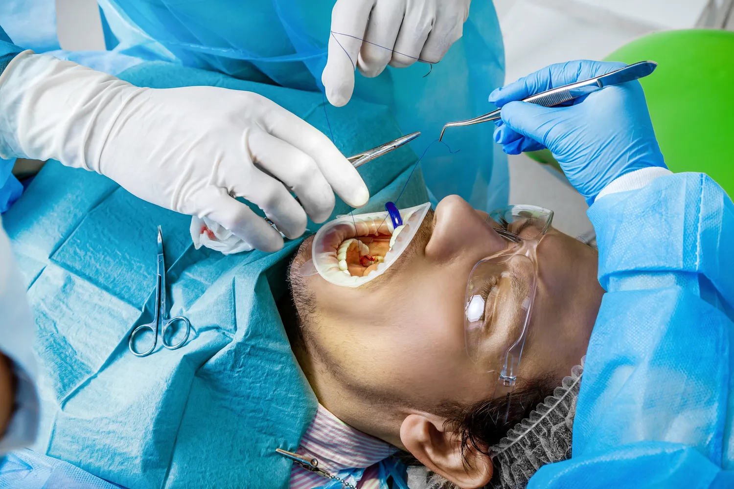 Implanty dentystyczne Warszawa