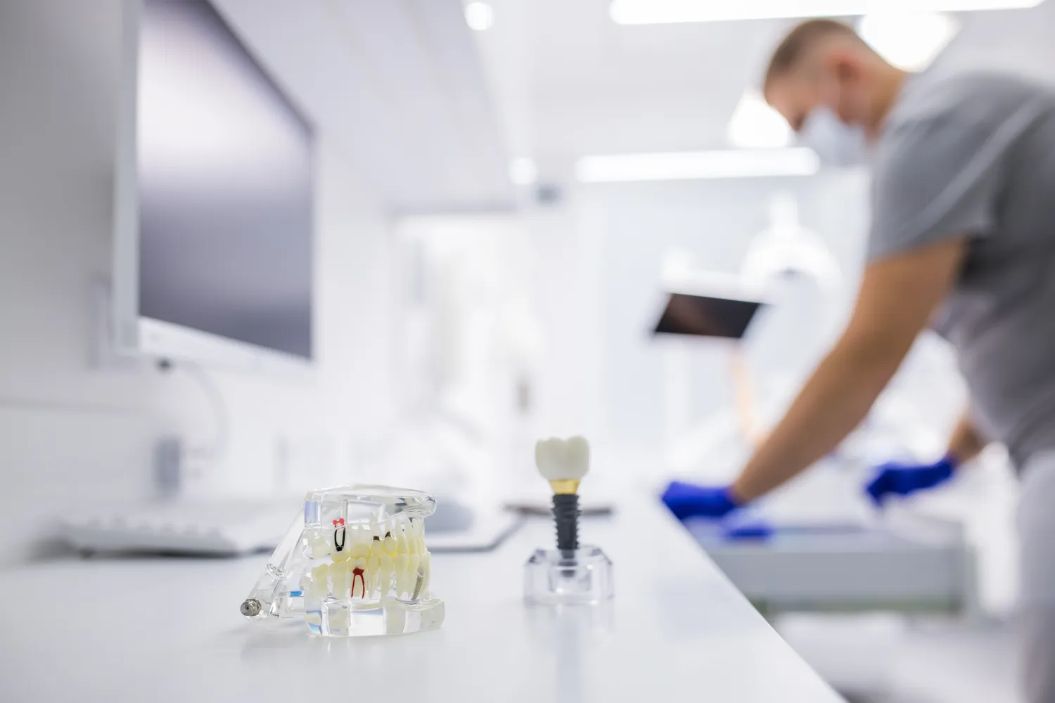 Ile kosztują implanty zębów w Polsce?