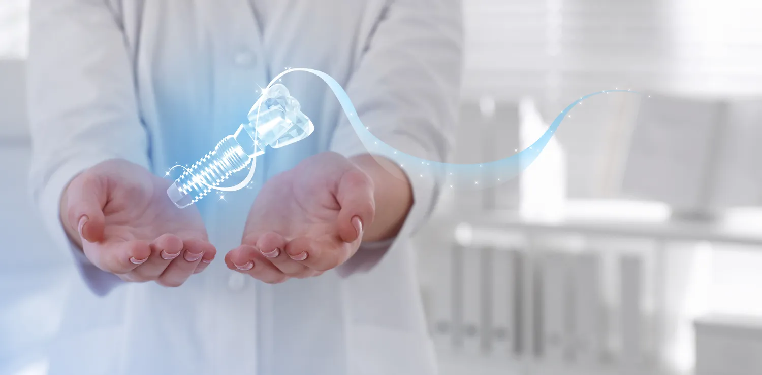 Ile kosztują implanty zębów w Turcji?