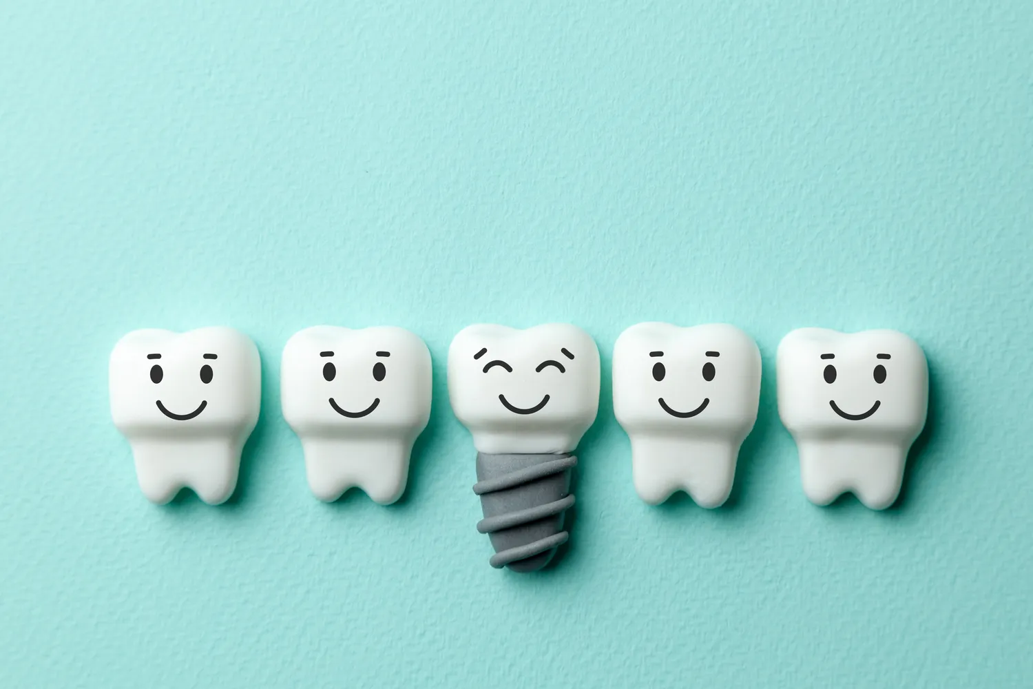 Ile trwa leczenie kanałowe pod mikroskopem?