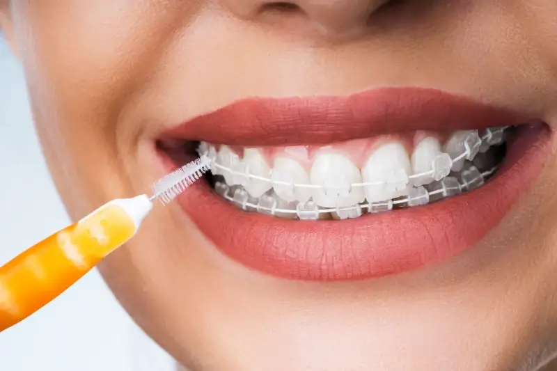 Stomatolog przyjazny dzieciom