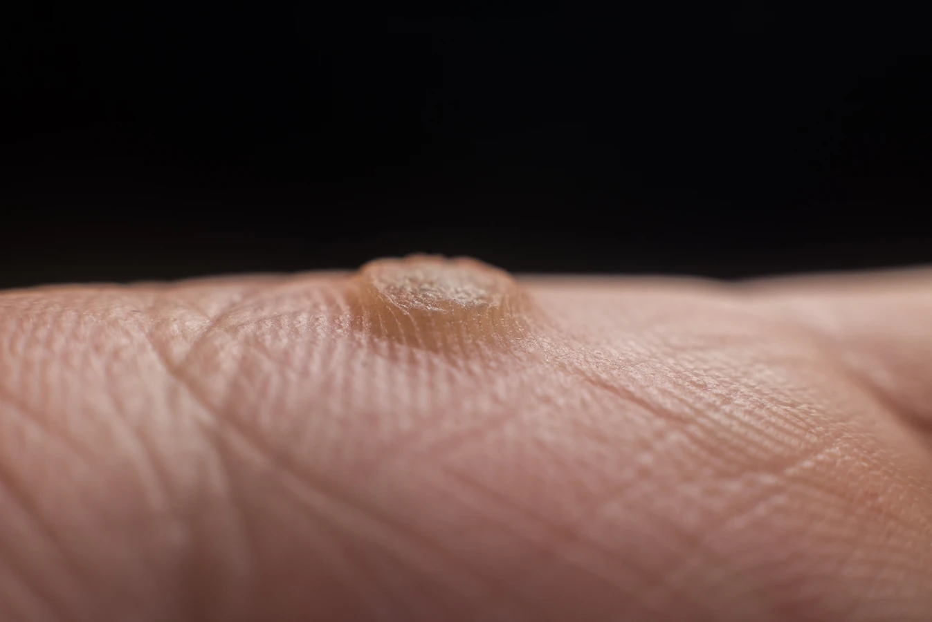 Kiedy należy udać się do gabinetu podologicznego?